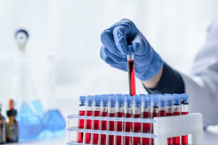 Laboratory,And,Science,Experiments,,Chemical,Hand,Taking,A,Blood,Sample