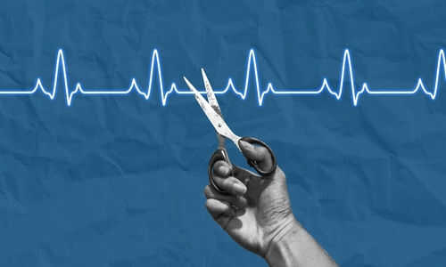 Hand holding scissors near heartbeat line illustration
